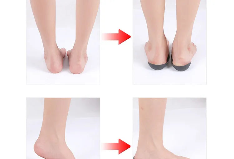 Orthopedic Insoles Orthotics Flat Foot Health Sole Pad For Shoes Insert Arch Support Pad For Feet Care Insoles Unisex 1 Pair