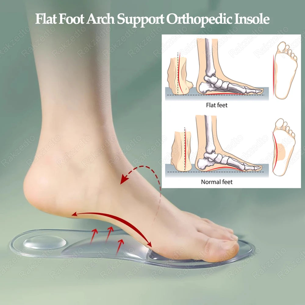 Medical Silicone Orthopedic Insoles for Shoes Women FlatFoot Arch Support Insoles for Plantar Fascitis Foot Massage Gel Shoe Pad